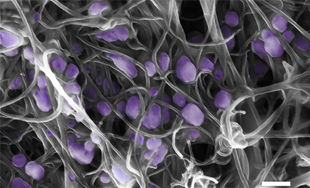 Scanning electron microscope image (scale bar, 200 nm) of the H5N2 avian influenza virus (purple) trapped inside the aligned carbon nanotubes.