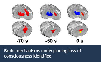 Twelve depictions of a brain