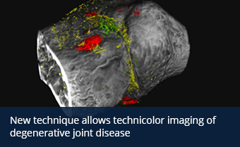 CT image with colors